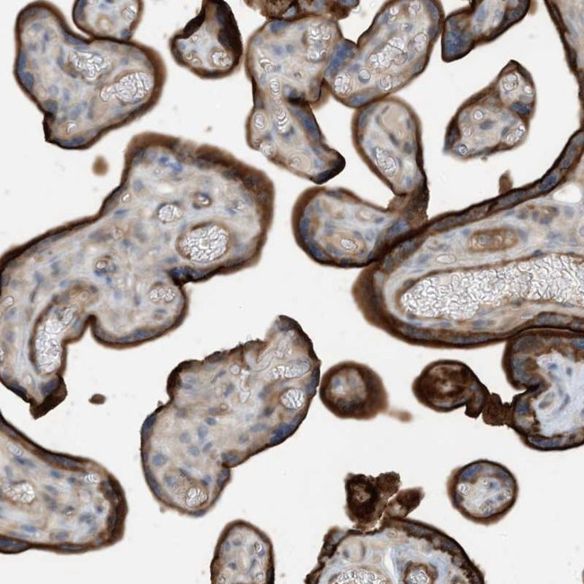 KBP Antibody in Immunohistochemistry (IHC)