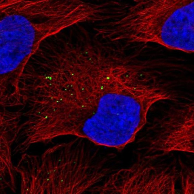 KISS1 Antibody in Immunocytochemistry (ICC/IF)