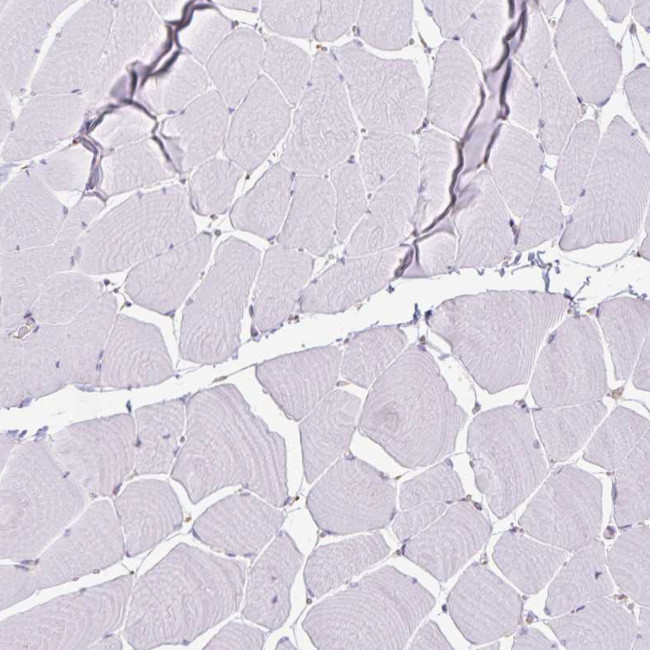 KISS1 Antibody in Immunohistochemistry (IHC)