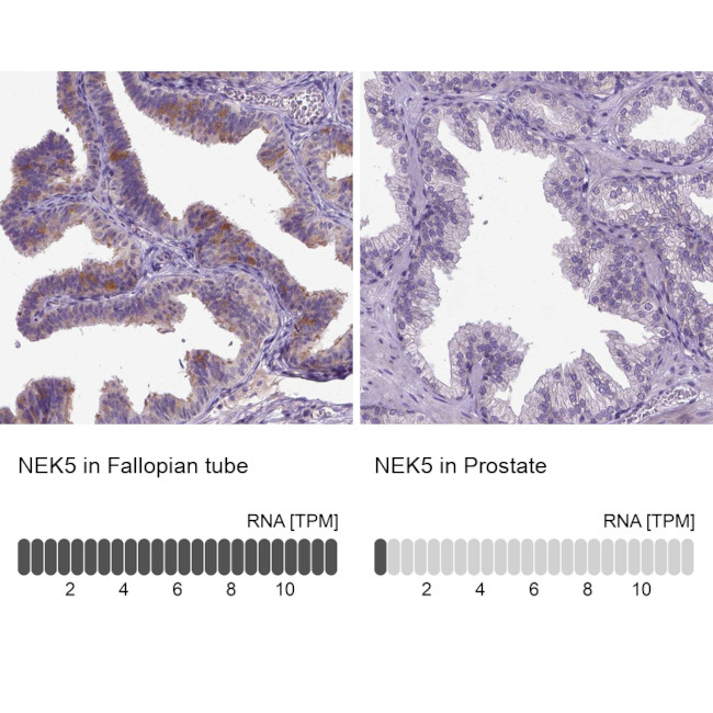 NEK5 Antibody