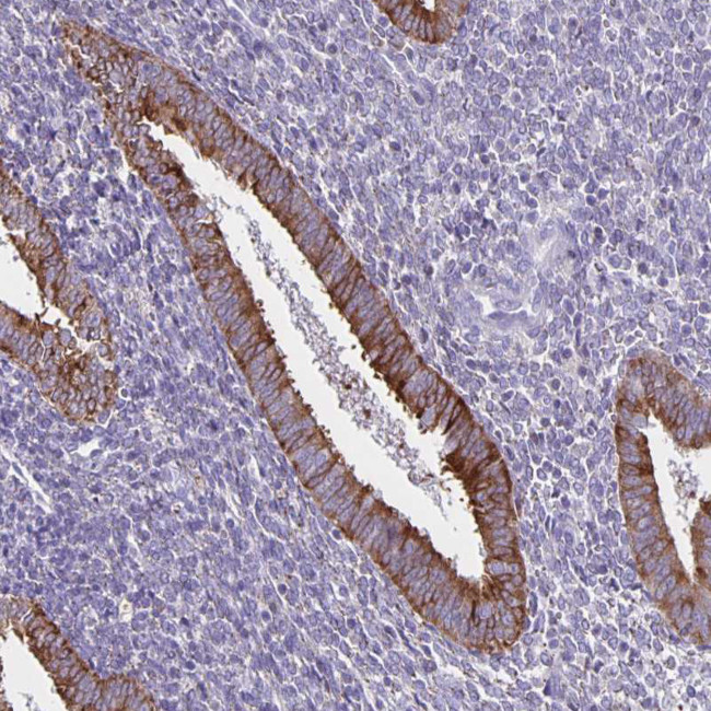 TRH Antibody in Immunohistochemistry (IHC)