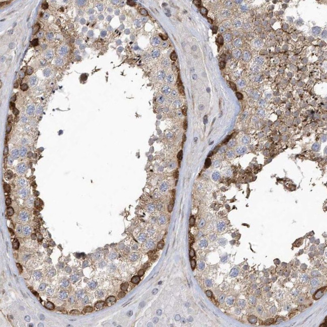 MAP7D3 Antibody in Immunohistochemistry (IHC)