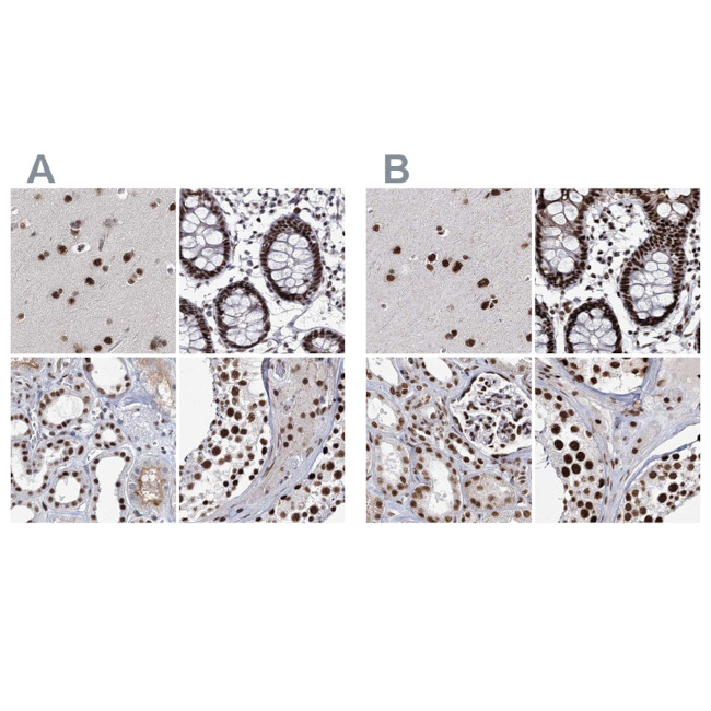 SCAF8 Antibody in Immunohistochemistry (IHC)