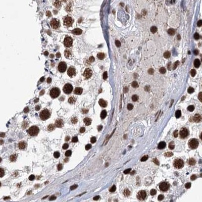 SCAF8 Antibody in Immunohistochemistry (IHC)