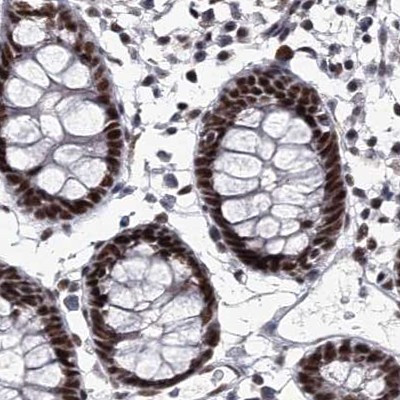 SCAF8 Antibody in Immunohistochemistry (IHC)