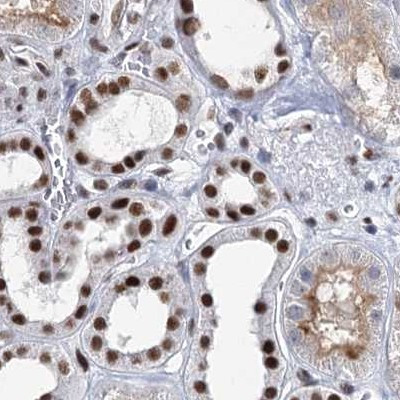 SCAF8 Antibody in Immunohistochemistry (IHC)