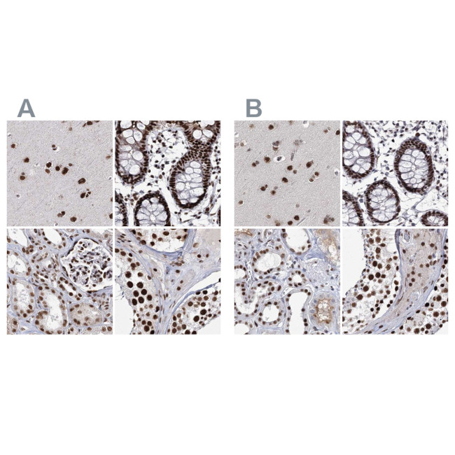 SCAF8 Antibody in Immunohistochemistry (IHC)