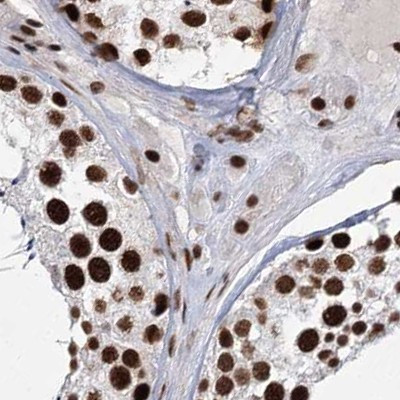 SCAF8 Antibody in Immunohistochemistry (IHC)