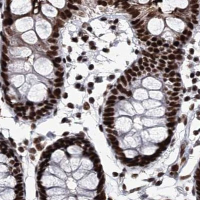 SCAF8 Antibody in Immunohistochemistry (IHC)