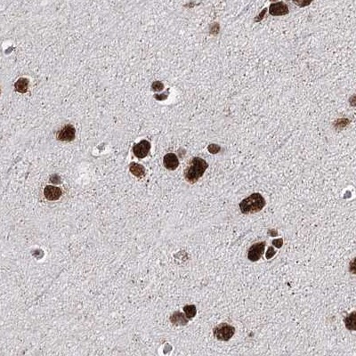 SCAF8 Antibody in Immunohistochemistry (IHC)