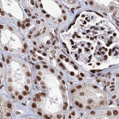 SCAF8 Antibody in Immunohistochemistry (IHC)