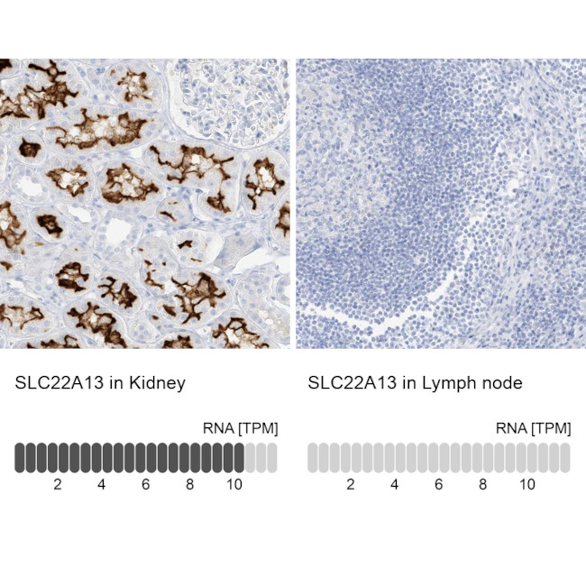 SLC22A13 Antibody in Immunohistochemistry (IHC)