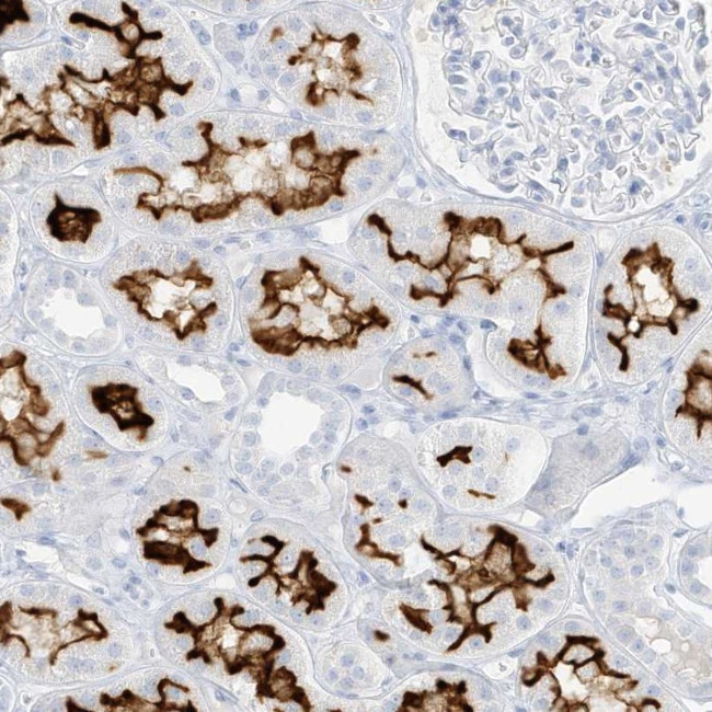 SLC22A13 Antibody in Immunohistochemistry (IHC)