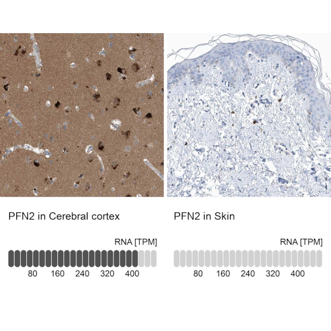 Profilin 2 Antibody