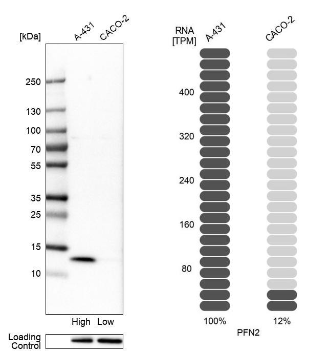 Profilin 2 Antibody