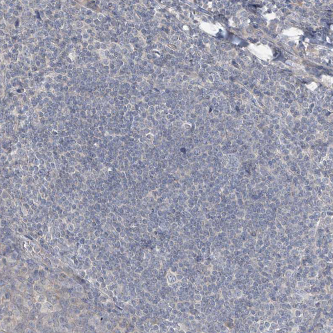 HOXA11 Antibody in Immunohistochemistry (IHC)