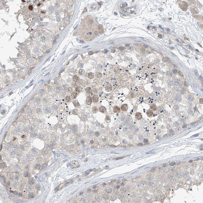 HOXA11 Antibody in Immunohistochemistry (IHC)