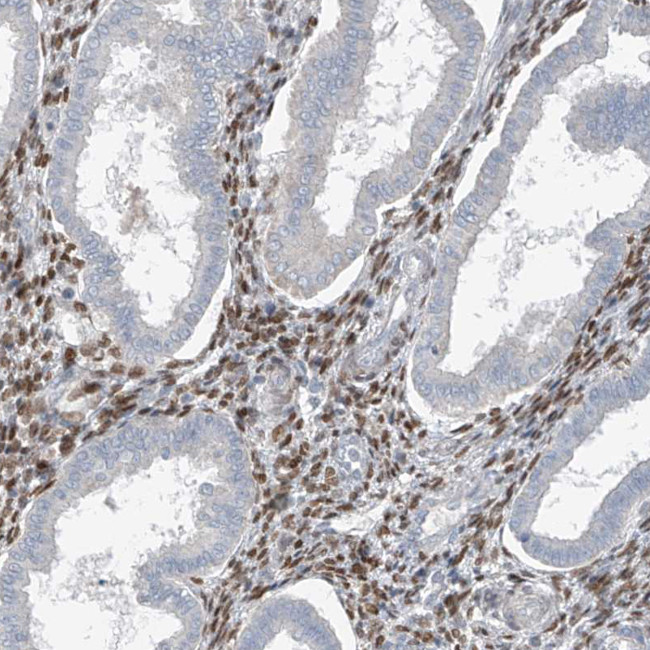 HOXA11 Antibody in Immunohistochemistry (IHC)