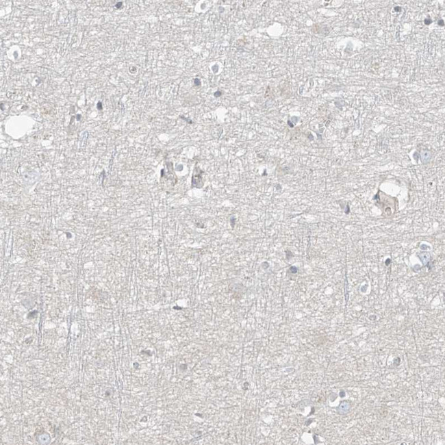 HOXA11 Antibody in Immunohistochemistry (IHC)