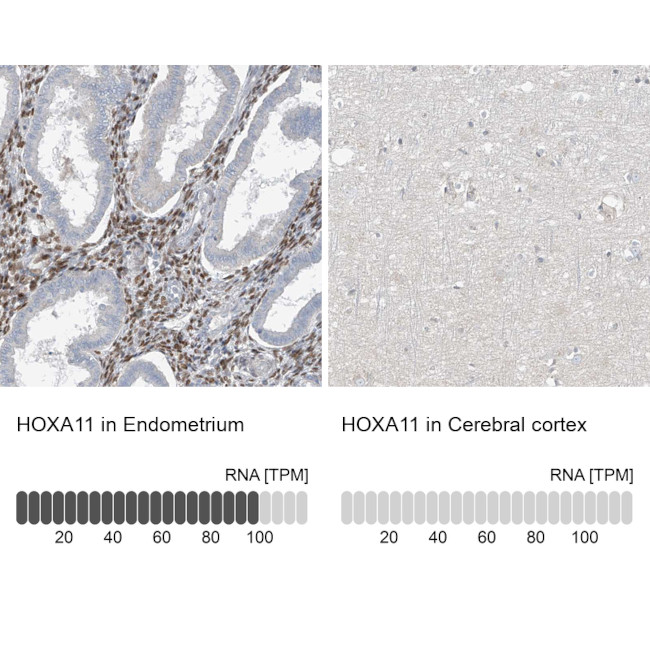 HOXA11 Antibody