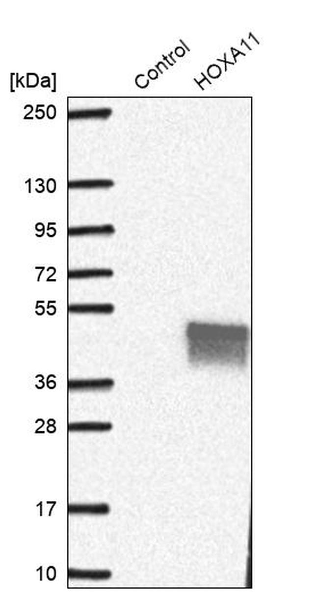 HOXA11 Antibody in Western Blot (WB)