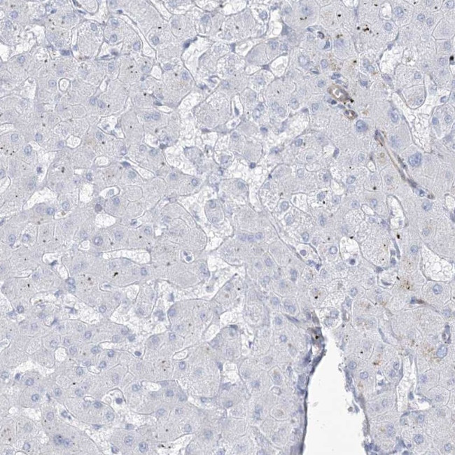 B3GNT7 Antibody in Immunohistochemistry (IHC)