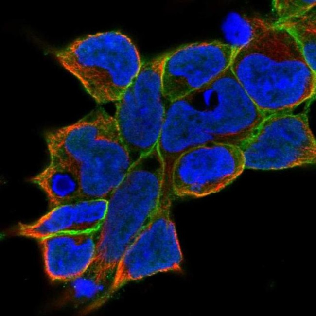 gamma Adducin Antibody in Immunocytochemistry (ICC/IF)