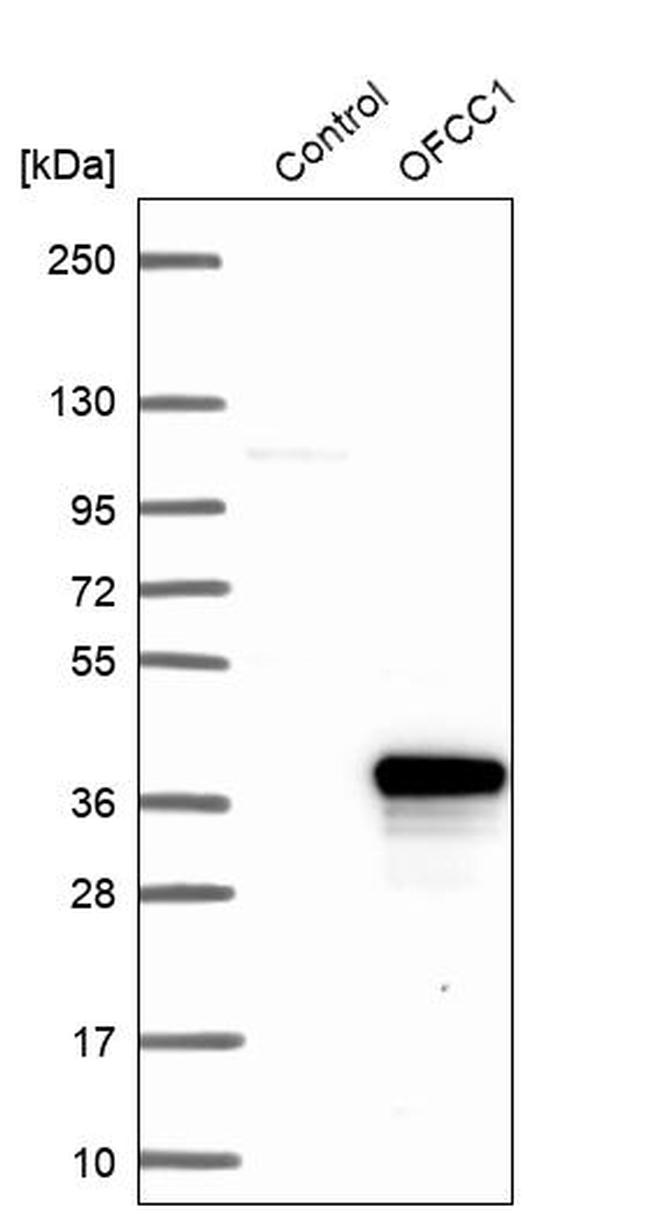 OFCC1 Antibody in Western Blot (WB)