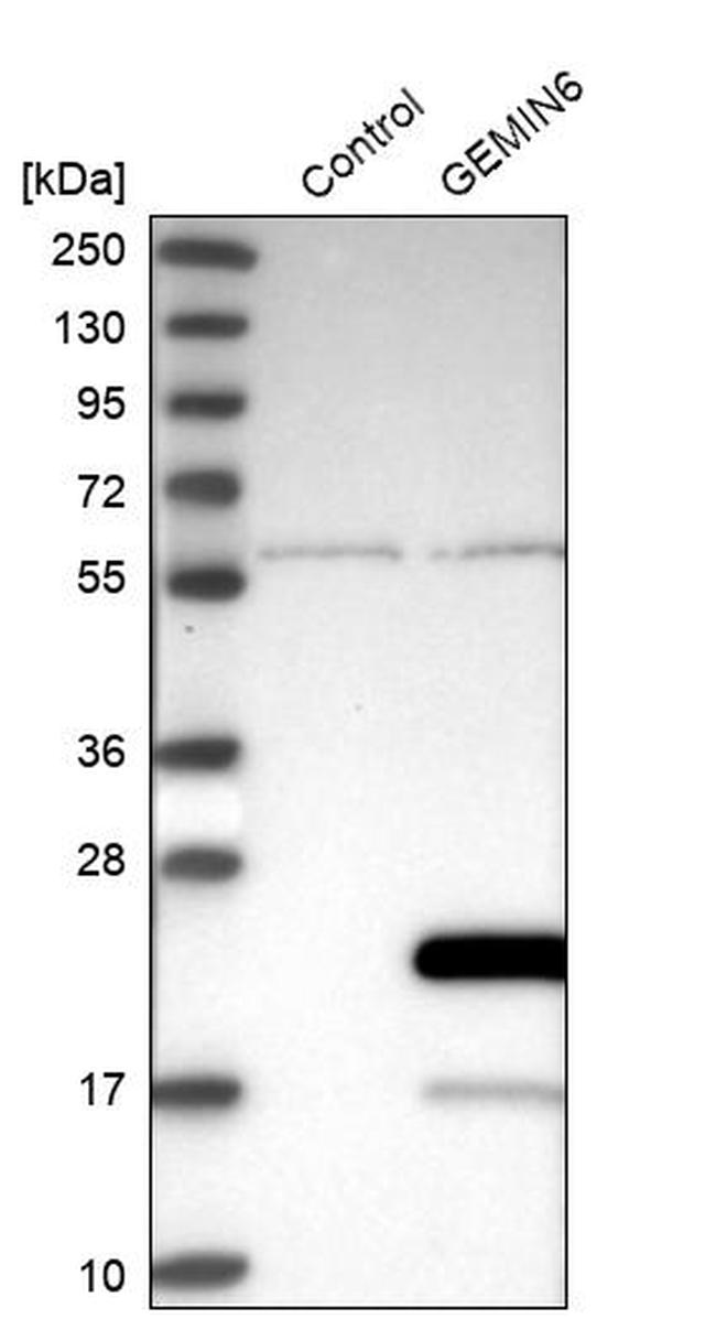 Gemin 6 Antibody in Western Blot (WB)