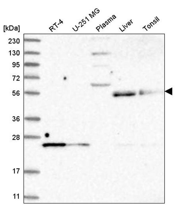 UNC93A Antibody in Western Blot (WB)