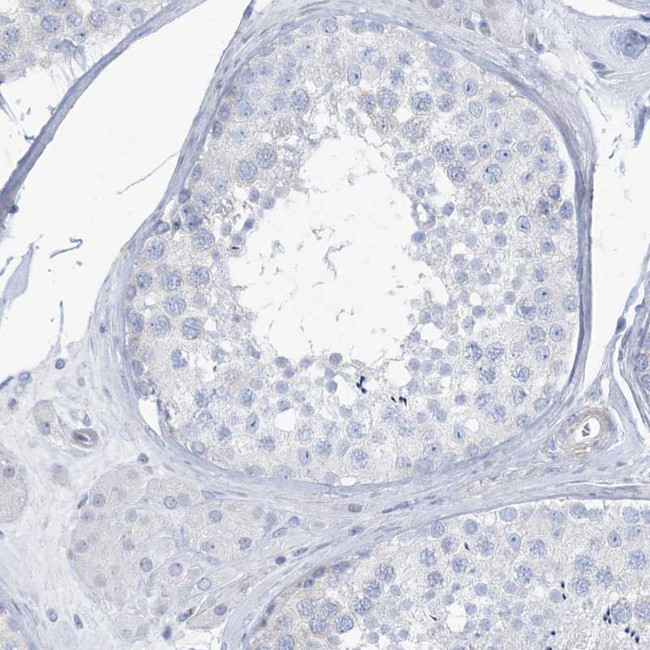 MOXD1 Antibody in Immunohistochemistry (IHC)