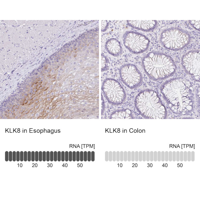 Kallikrein 8 Antibody in Immunohistochemistry (IHC)