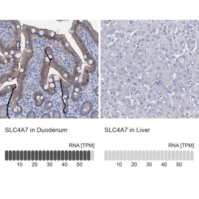 SLC4A7 Antibody