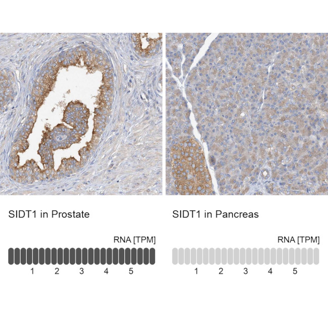 SIDT1 Antibody in Immunohistochemistry (IHC)