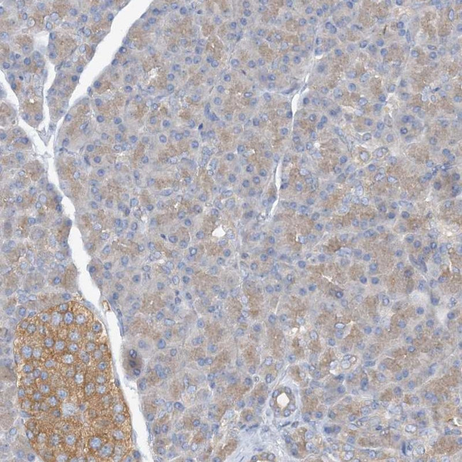 SIDT1 Antibody in Immunohistochemistry (IHC)