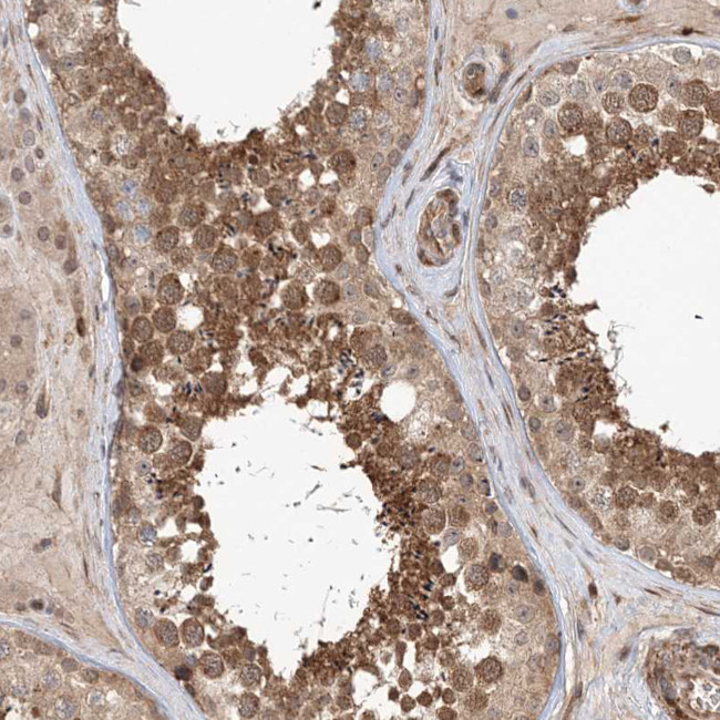 UBTD2 Antibody in Immunohistochemistry (IHC)