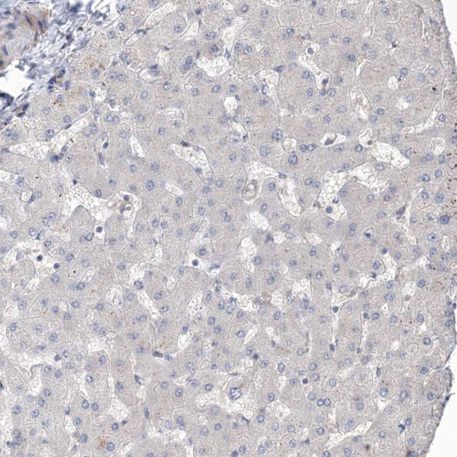 UBTD2 Antibody in Immunohistochemistry (IHC)