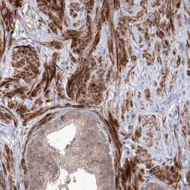 UBTD2 Antibody in Immunohistochemistry (IHC)