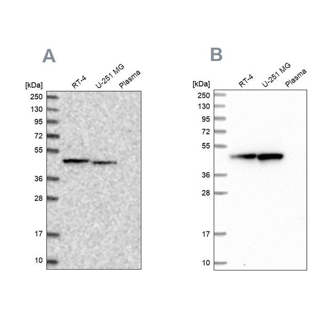 PAICS Antibody in Western Blot (WB)