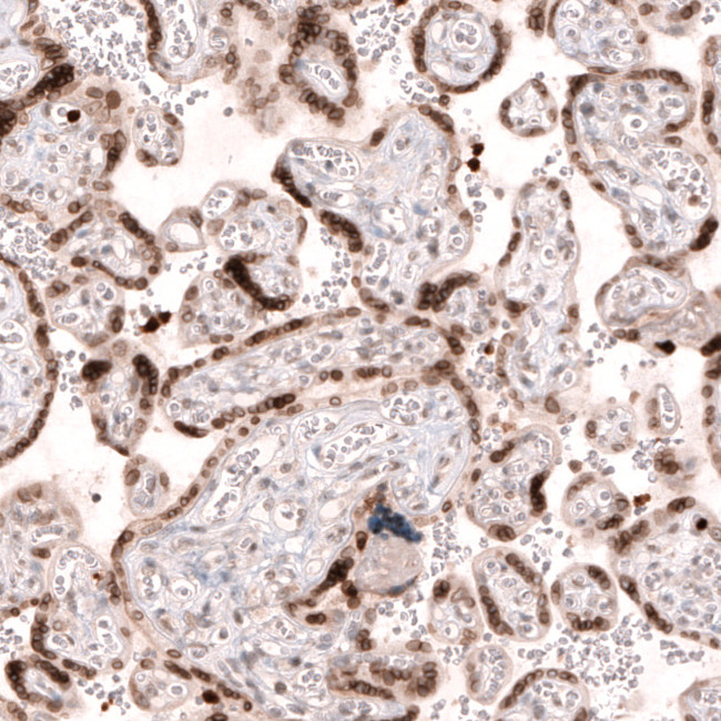 NUP54 Antibody in Immunohistochemistry (IHC)