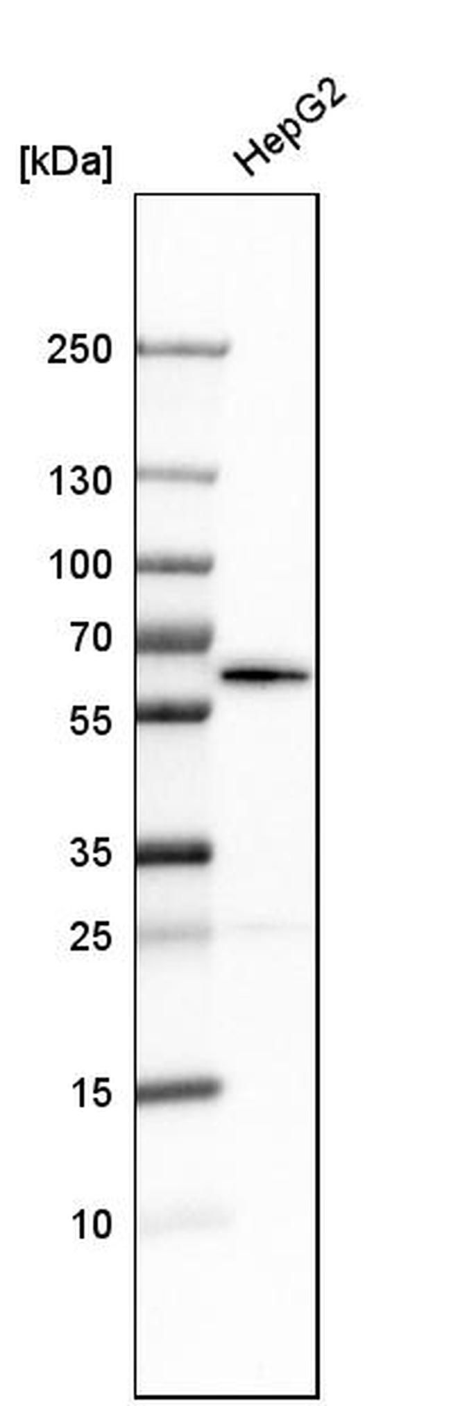 NUP54 Antibody in Western Blot (WB)