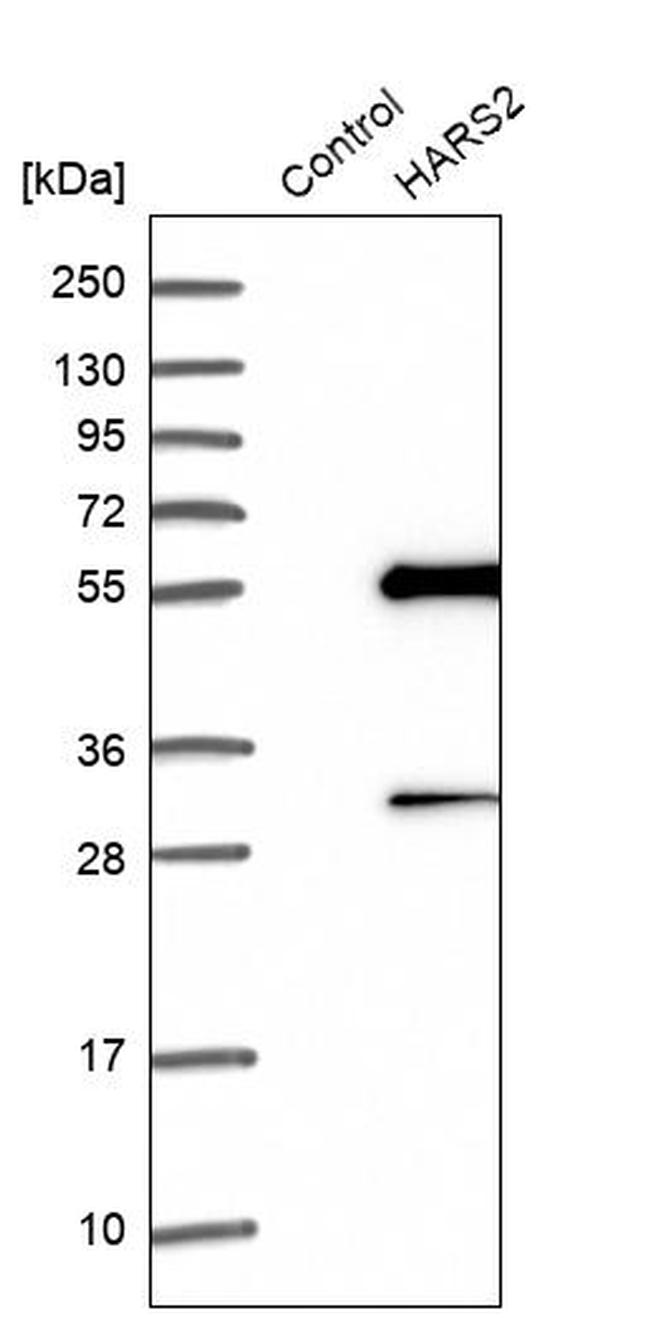 HARS2 Antibody in Western Blot (WB)