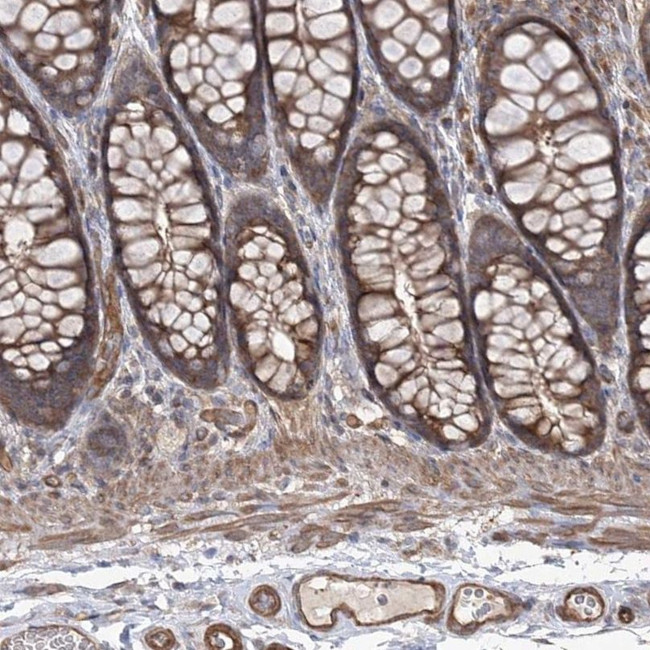 LARS2 Antibody in Immunohistochemistry (IHC)