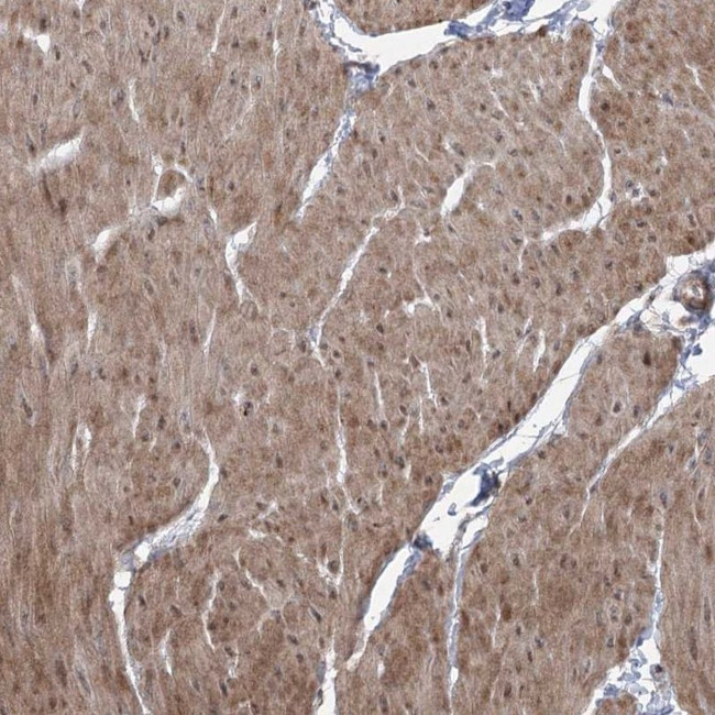 ZSCAN23 Antibody in Immunohistochemistry (IHC)