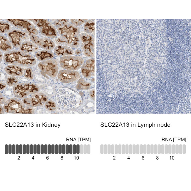 SLC22A13 Antibody in Immunohistochemistry (IHC)