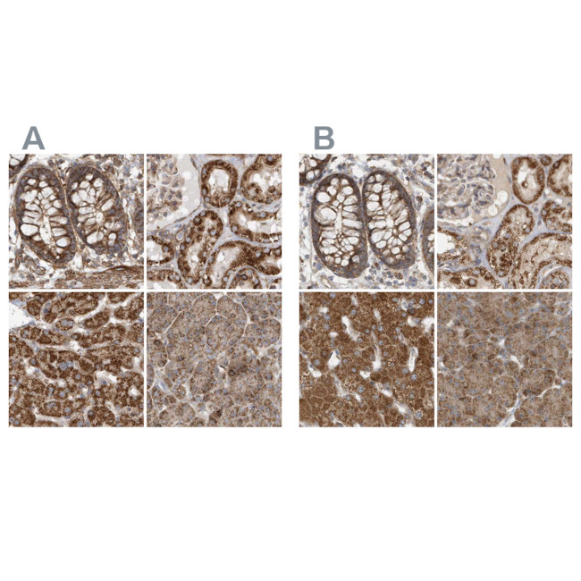 MUT Antibody in Immunohistochemistry (IHC)