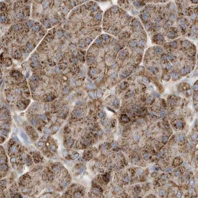 MUT Antibody in Immunohistochemistry (IHC)