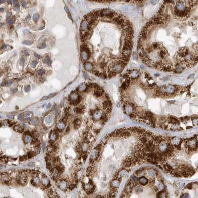 MUT Antibody in Immunohistochemistry (IHC)