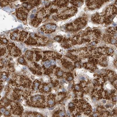 MUT Antibody in Immunohistochemistry (IHC)