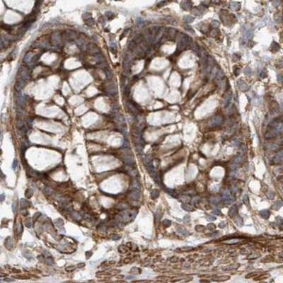 MUT Antibody in Immunohistochemistry (IHC)